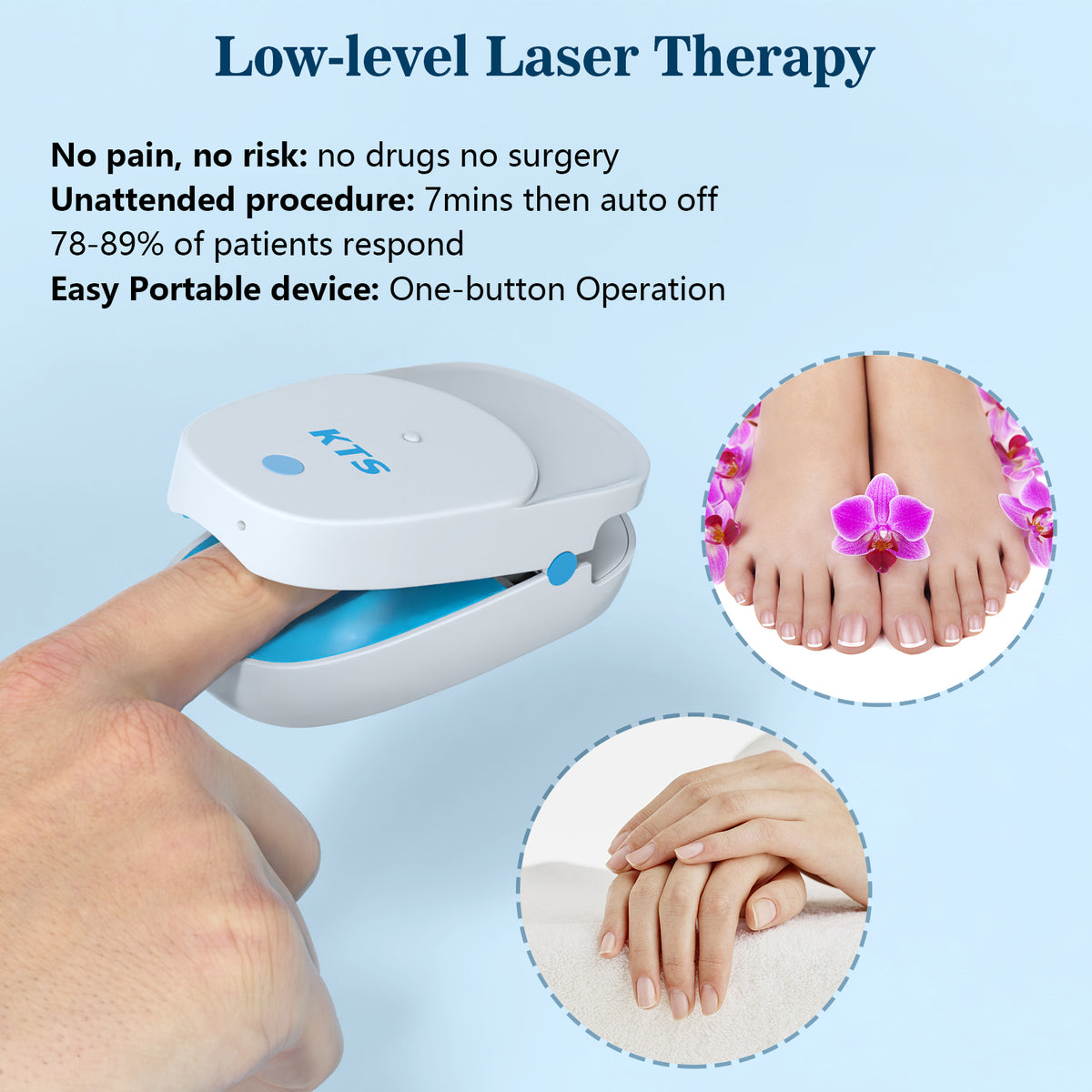 Fingernail Fungus Removal Light Therapy Treatment LLLT Nail